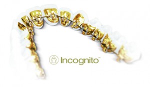 incognito2